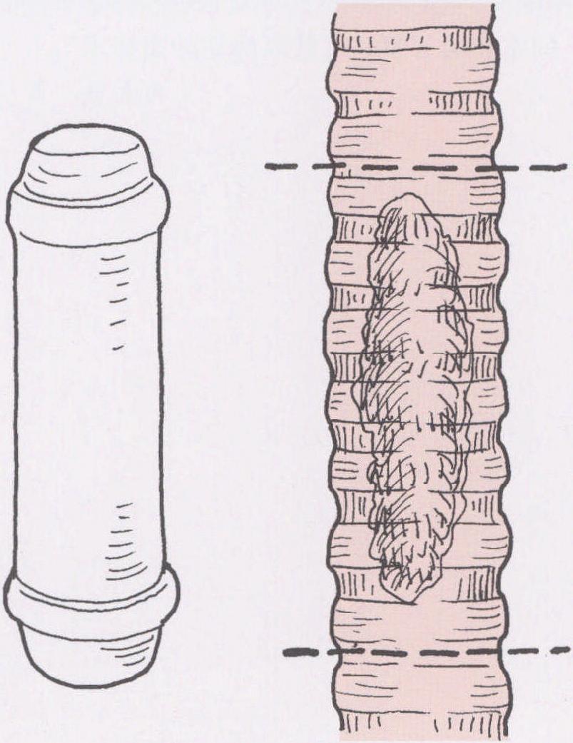 第七節(jié) 人工氣管置管術(shù)